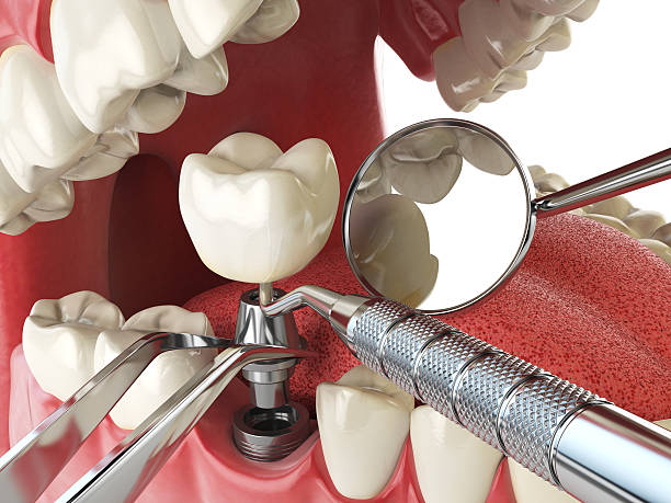 Best Tooth Pain Emergency Relief  in Lford, MI